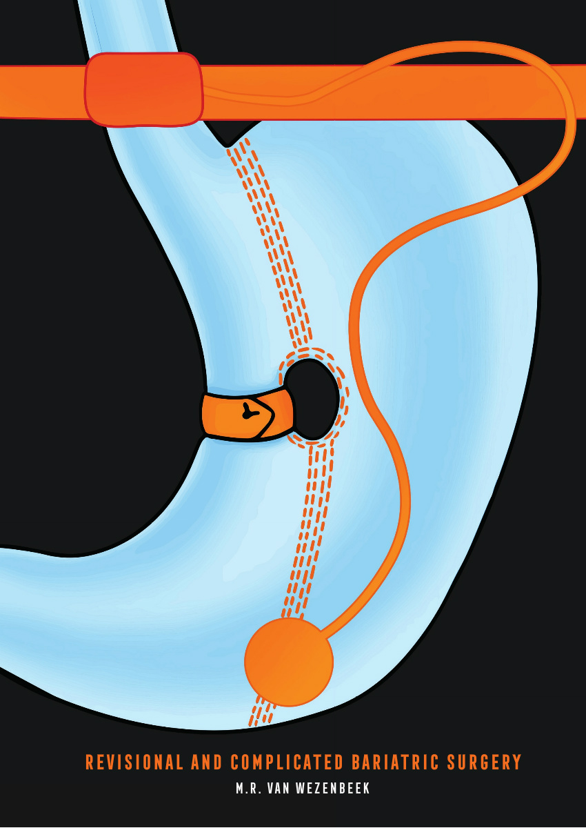 Martin Van Wezenbeek