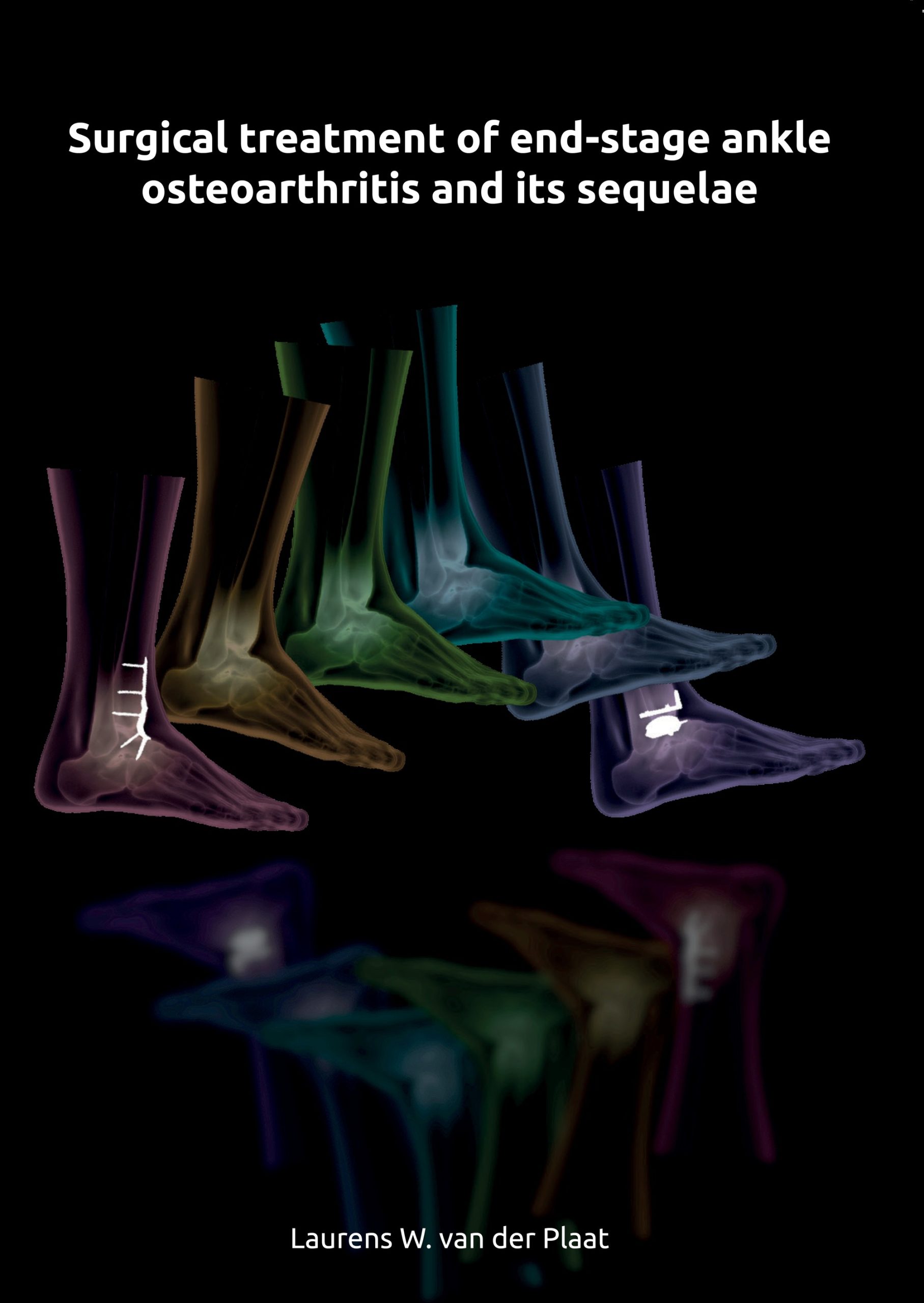 Laurens Van Der Plaat